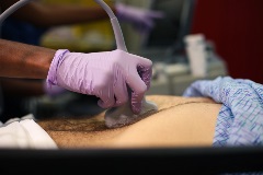 aortasagittalproximal2