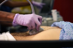 aortasagittalproximal2