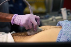 aortasagittalproximal3