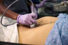 aortatransversedistal1