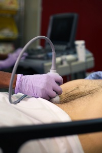 aortatransversedistal3