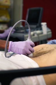 aortatransversedistal3