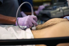 aortatransversedistal5