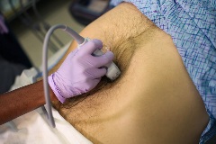 aortatransverseproximal3