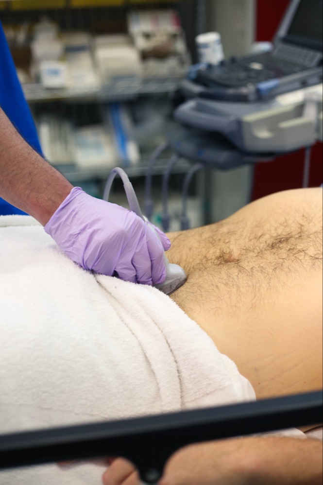 bladdertransverse2