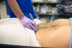 SuprapubicTransverse2