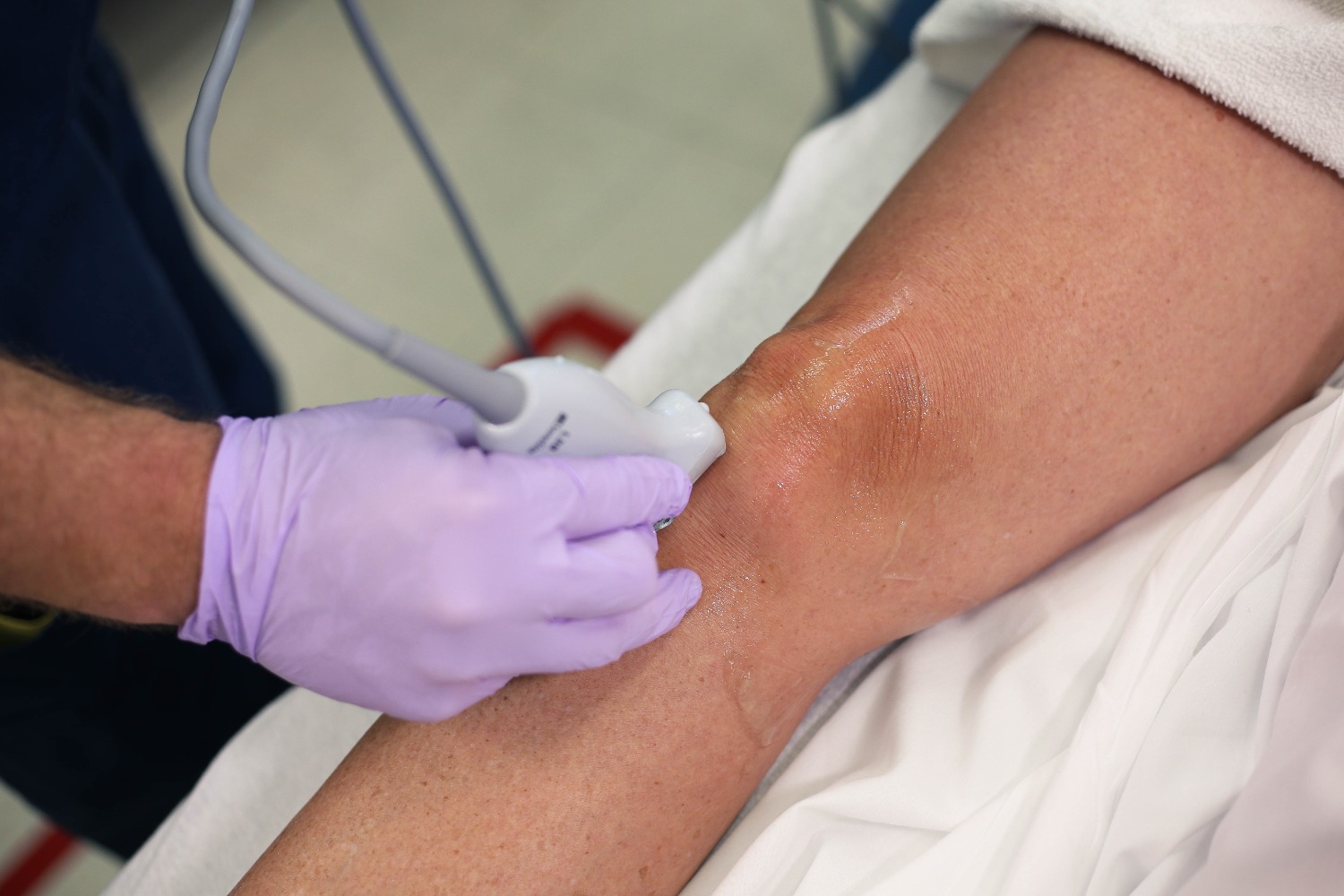 infrapatellar_patellatendon