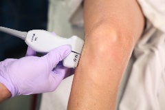 lateralmeniscus_LCL1