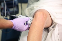 lateralmeniscus_LCL2