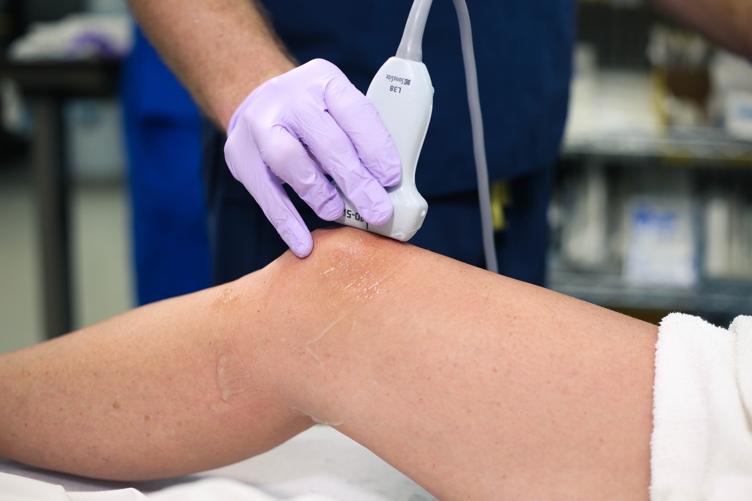 suprapatellar_quadracepstendon2