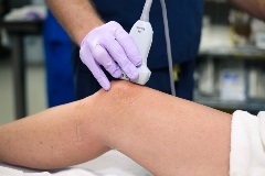 suprapatellar_quadracepstendon2