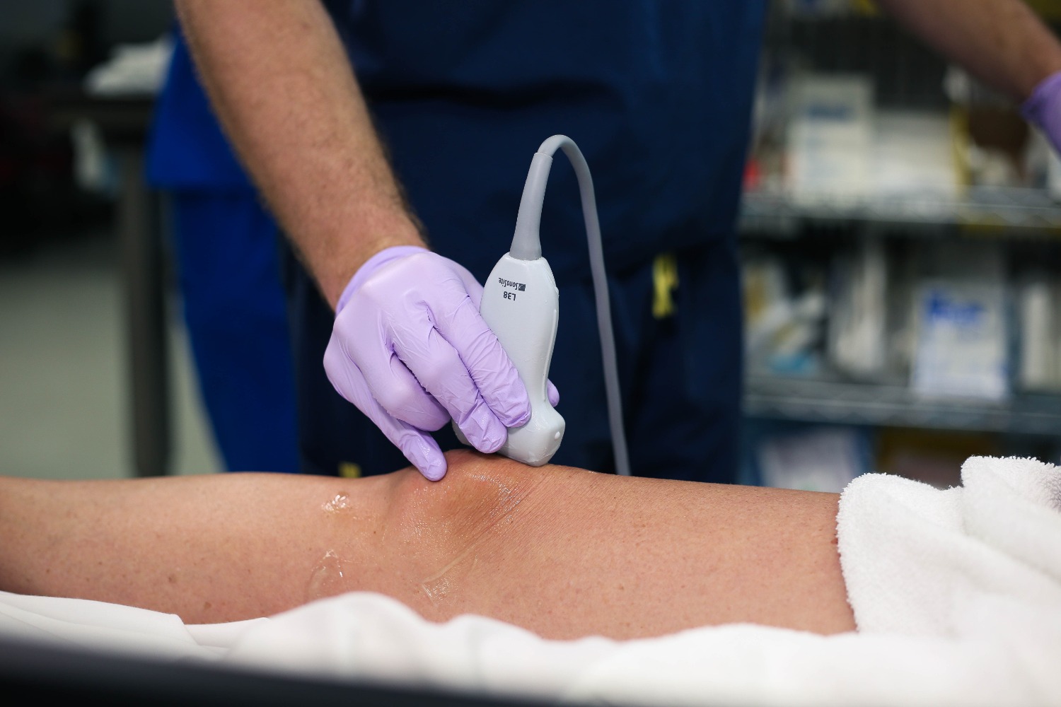 suprapatellar_quadracepstendon3