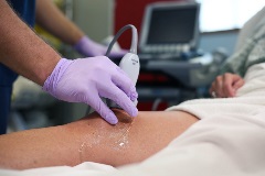 suprapatellar_quadracepstendon4