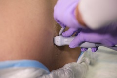 USguidedLPtransverse4