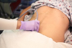 OBtransabdominaltransverse2