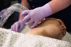 cervicalplexusblock5