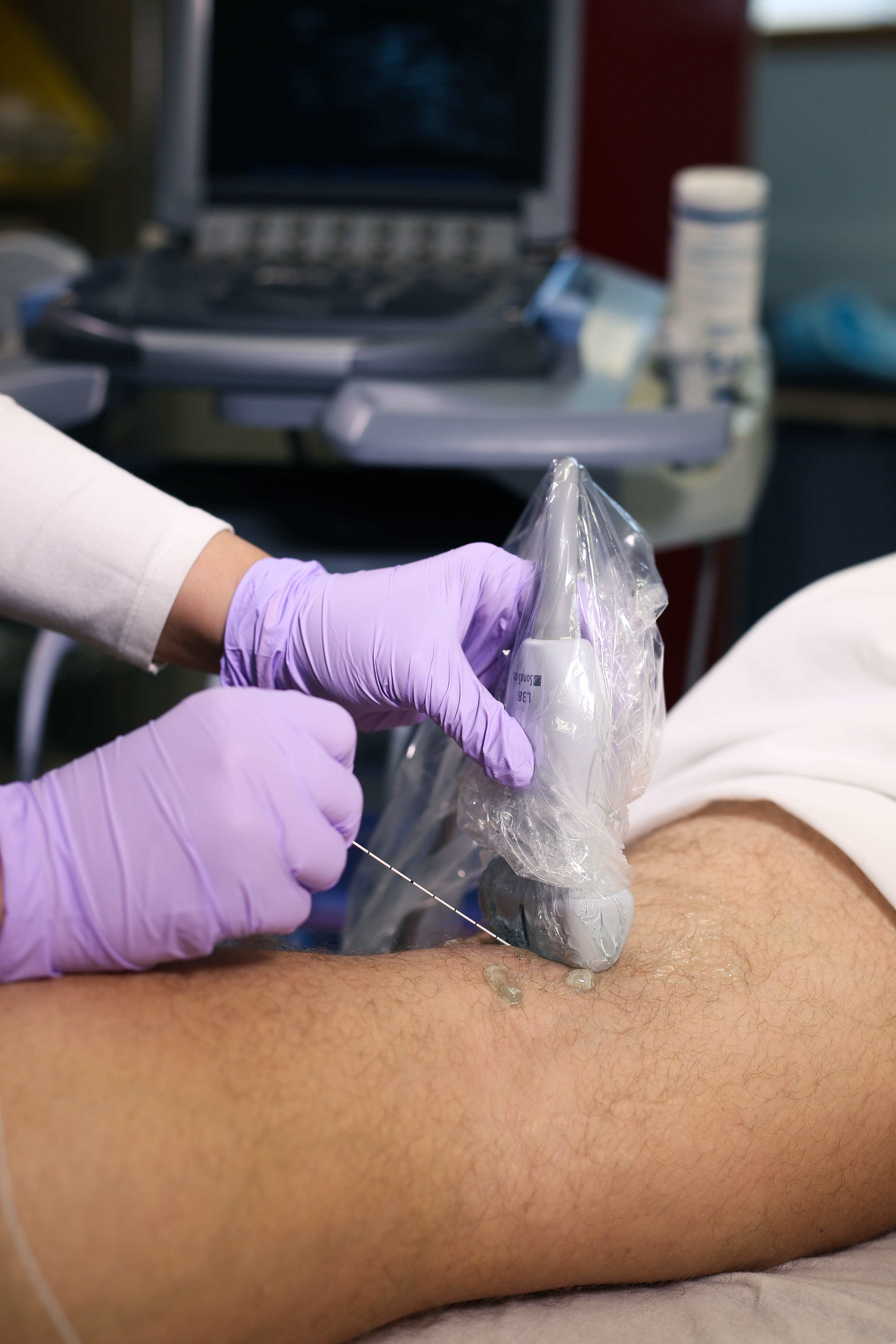 pop-sciaticblockout-of-plane