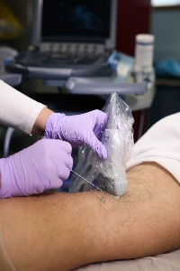 pop-sciaticblockout-of-plane