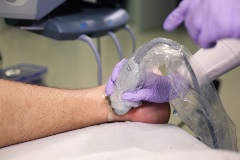 posteriortibialnerveblock2