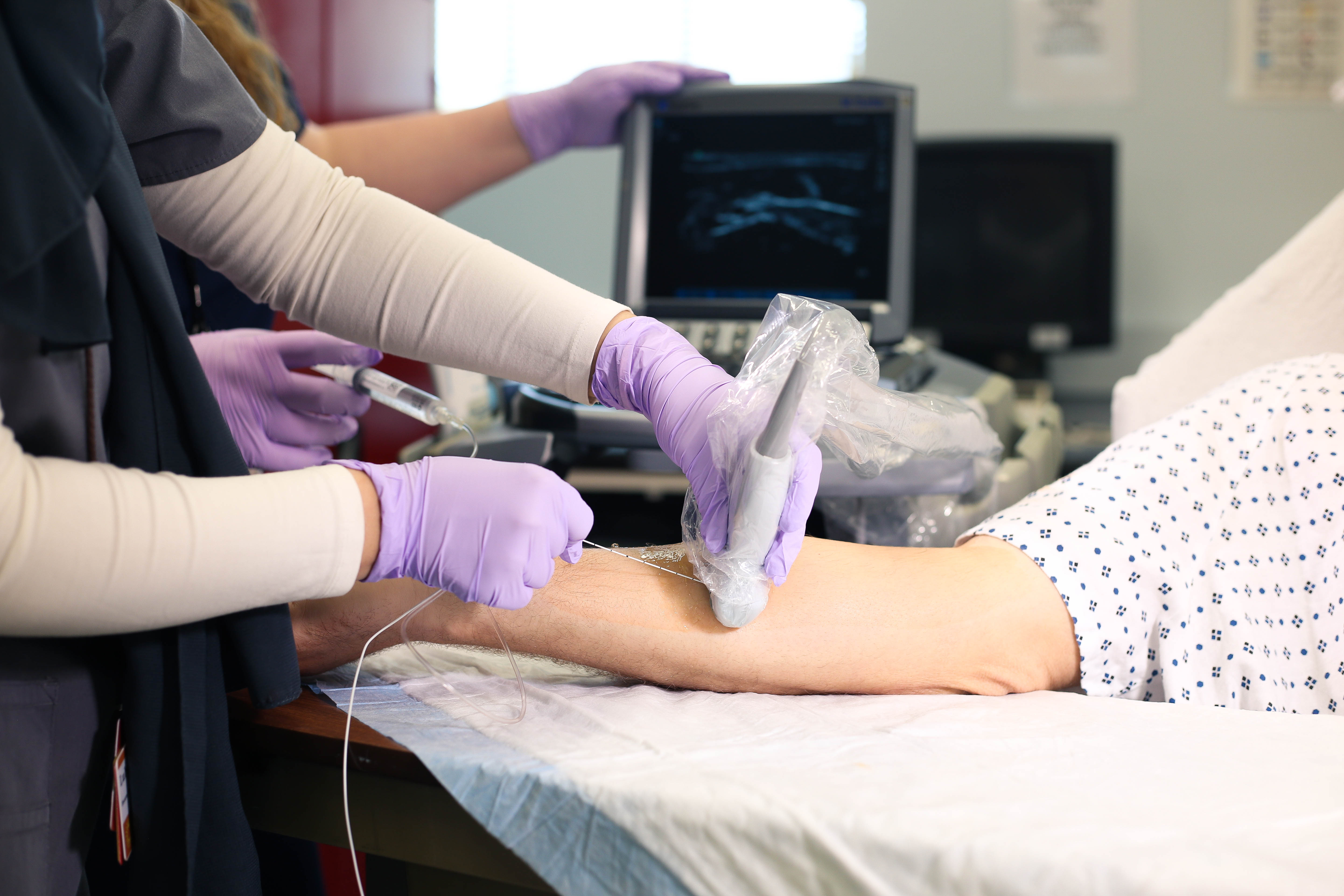 ulnarnerveblockoutofplane