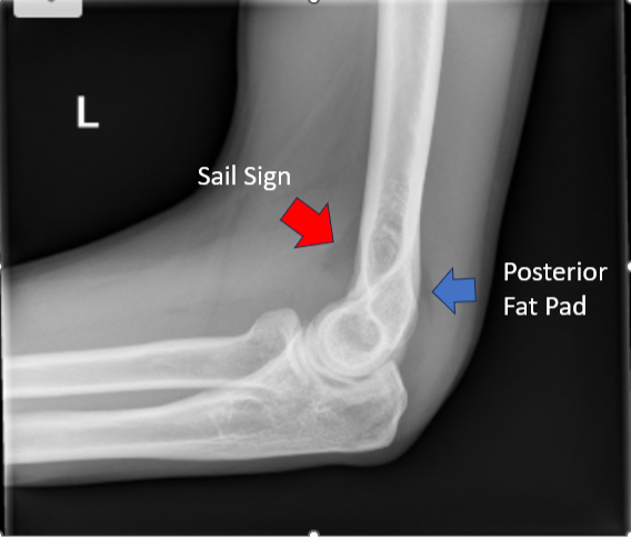 Orthopedic Injuries SAEM Orthopedic Injuries SAEM