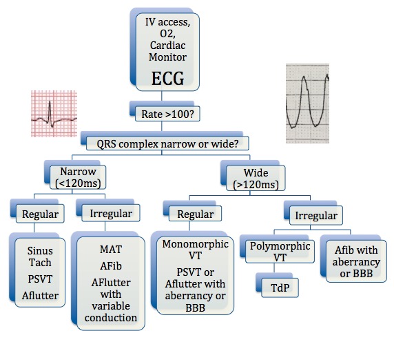 Circulation - Tachydysrhythmias | SAEM