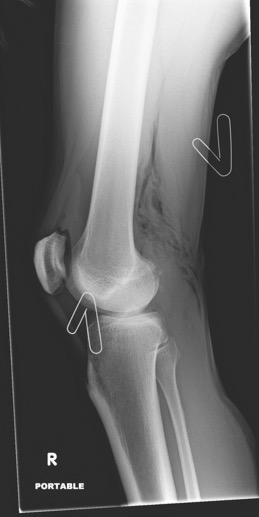 M3 Fig 1 Orthopedic Injuries -knee-cropped
