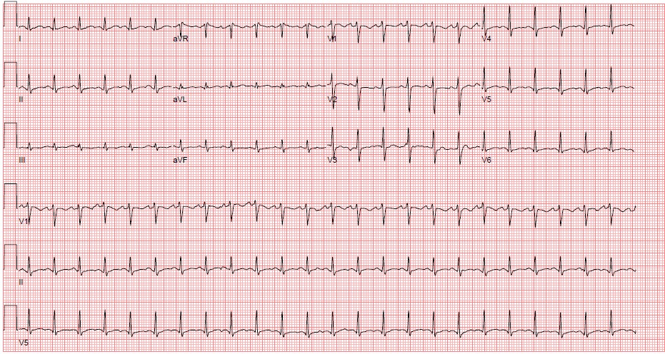 M3 Fig 2 Circulation -sinus-tachycardia