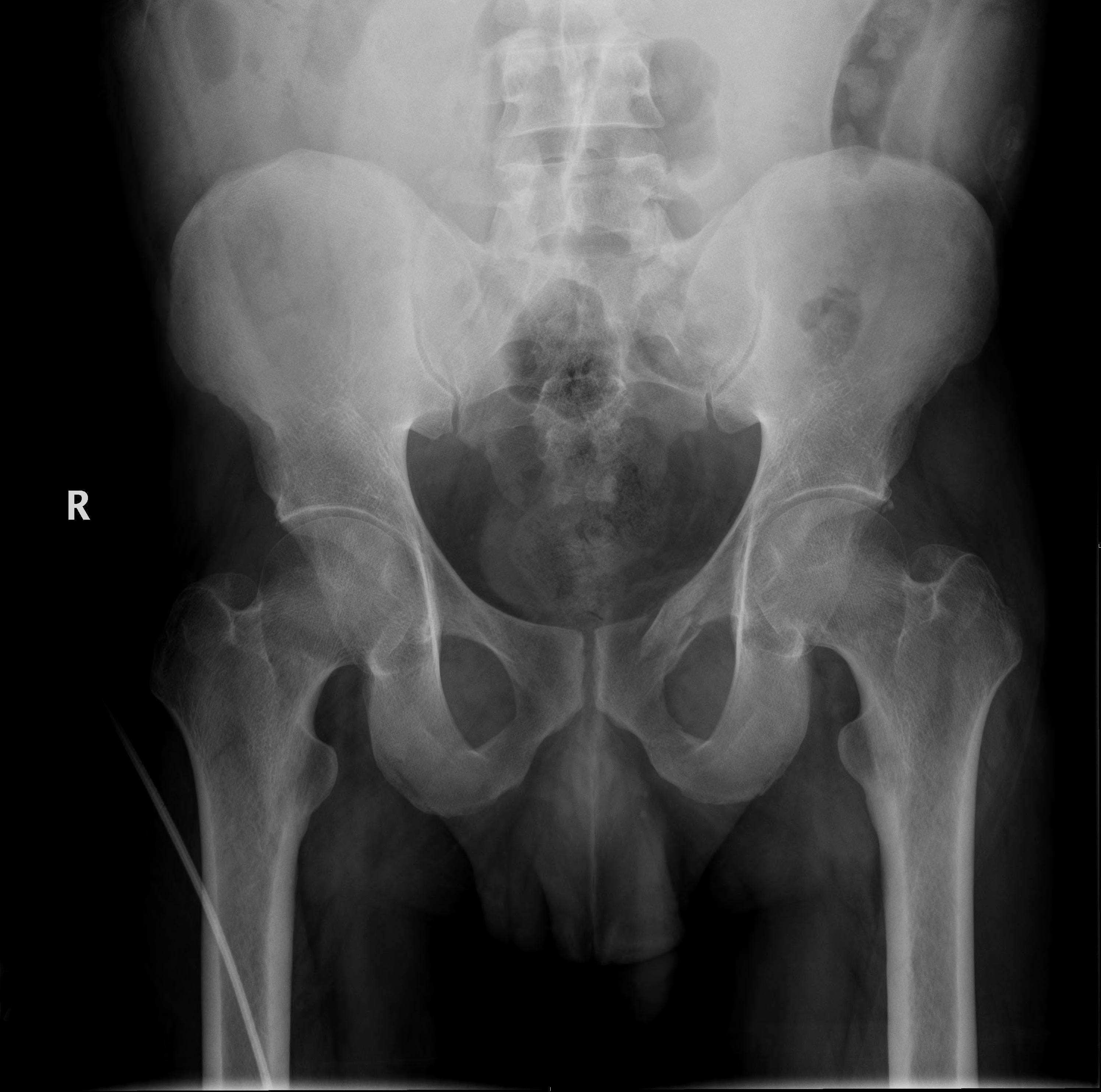 M3 Fig 6 Orthopedic Injuries -pelvis
