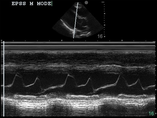M3 Fig 7 Bedside Ultrasound -m-mode