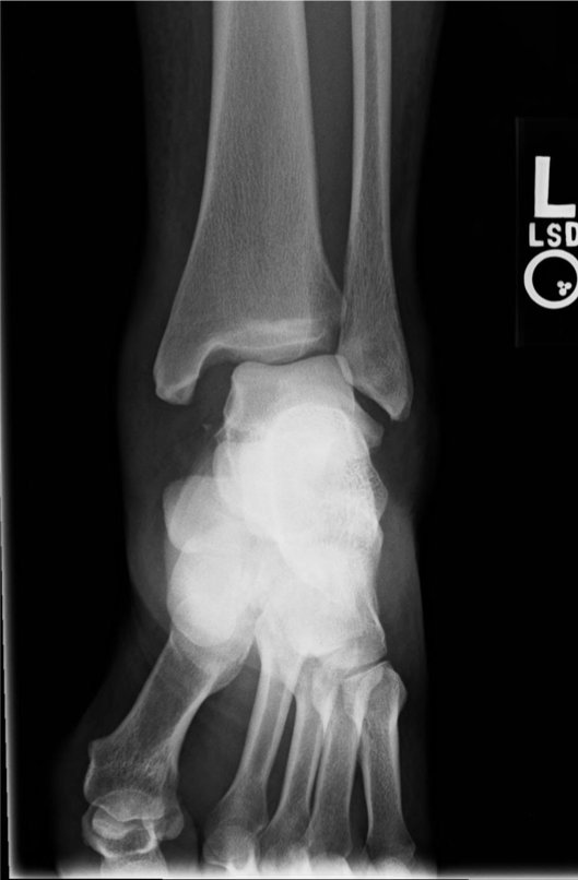 M3 Fig 8 Orthopedic Injuries -ankle-injury