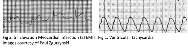 M4 Fig 3 Chest Pain
