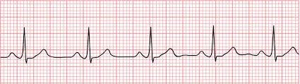 M4 Fig 5 Cardiac Arrest