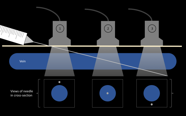 venous-access-image-10