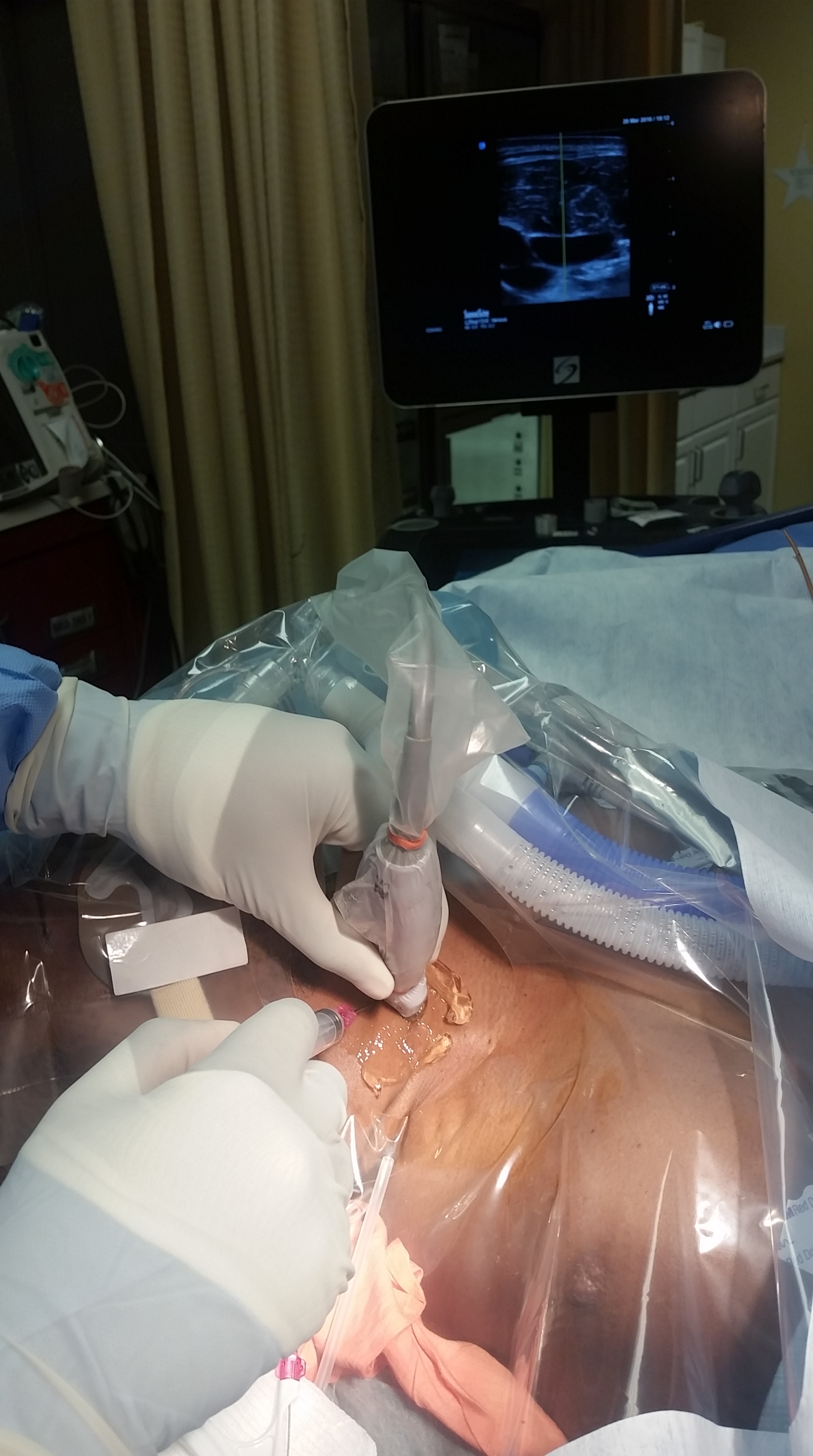 venous-access-image-14